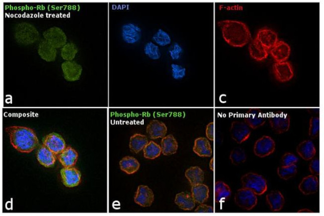 Phospho-Rb (Ser788) Antibody in Immunocytochemistry (ICC/IF)