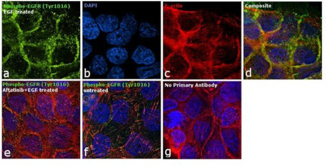 Phospho-EGFR (Tyr1016) Antibody in Immunocytochemistry (ICC/IF)