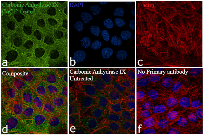 Carbonic Anhydrase IX Antibody in Immunocytochemistry (ICC/IF)