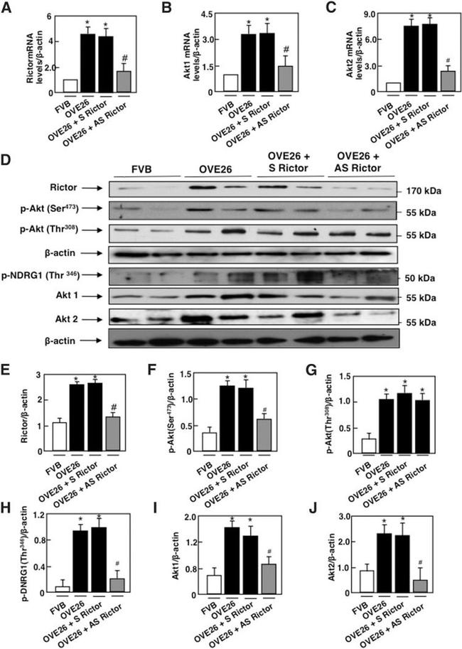 Phospho-NDRG1 (Thr346) Antibody in Western Blot (WB)