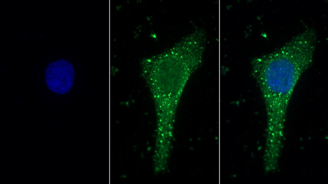Laminin alpha-1 Antibody in Immunocytochemistry (ICC/IF)