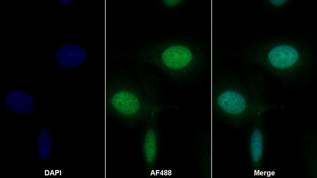 CD155 Antibody in Immunocytochemistry (ICC/IF)