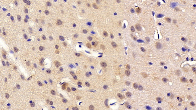 DVL1 Antibody in Immunohistochemistry (Paraffin) (IHC (P))
