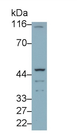 TBXA2R Antibody in Western Blot (WB)