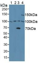 ADAM8 Antibody in Western Blot (WB)