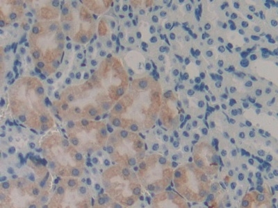 LECT2 Antibody in Immunohistochemistry (Paraffin) (IHC (P))