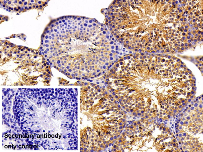 GAL3ST1 Antibody in Immunohistochemistry (Paraffin) (IHC (P))