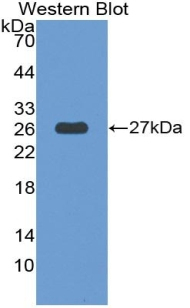 THSD7A Antibody in Western Blot (WB)