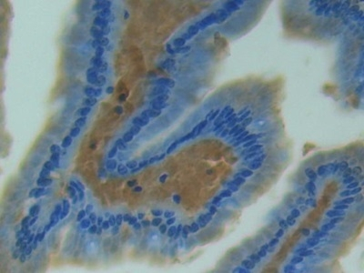 iNOS Antibody in Immunohistochemistry (Paraffin) (IHC (P))