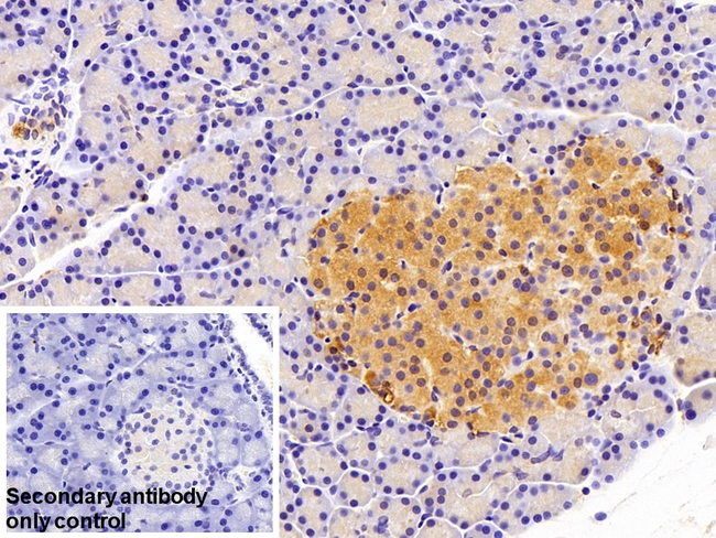 A1CF Antibody in Immunohistochemistry (Paraffin) (IHC (P))