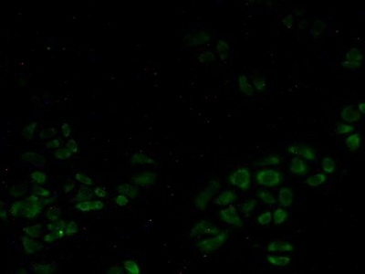 SMN1 Antibody in Immunocytochemistry (ICC/IF)