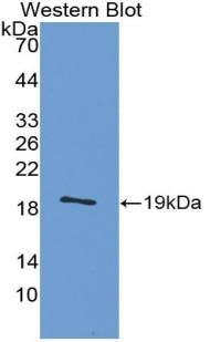 CALCB Antibody in Western Blot (WB)