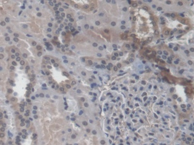 RAB37 Antibody in Immunohistochemistry (Paraffin) (IHC (P))