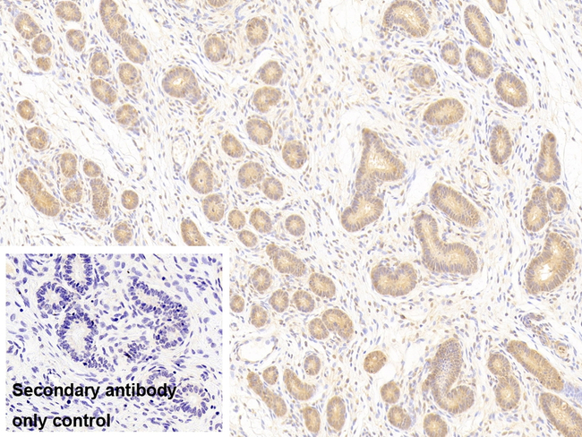 PTPRM Antibody in Immunohistochemistry (Paraffin) (IHC (P))