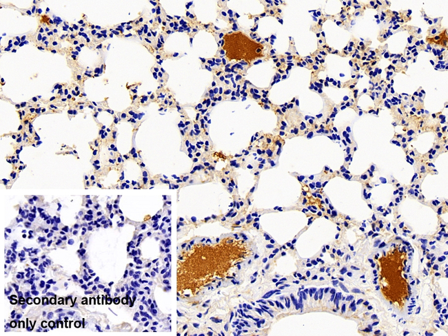 Complement C5a Antibody in Immunohistochemistry (Paraffin) (IHC (P))