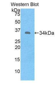 MT1E Antibody in Western Blot (WB)