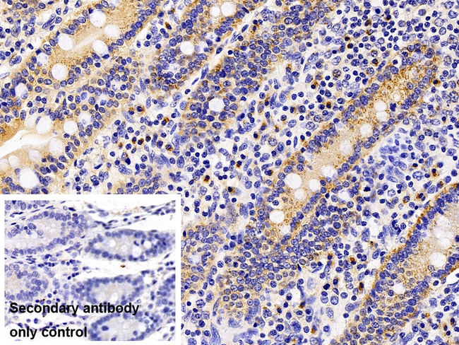 LAMP1 Antibody in Immunohistochemistry (Paraffin) (IHC (P))