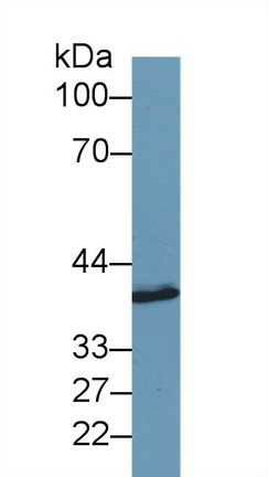 SYTL2 Antibody in Western Blot (WB)
