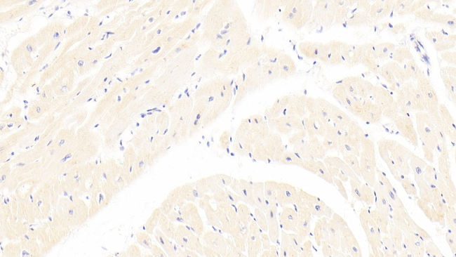 LPA Antibody in Immunohistochemistry (Paraffin) (IHC (P))