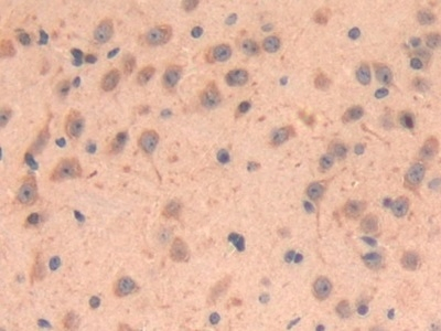 LOXL3 Antibody in Immunohistochemistry (Paraffin) (IHC (P))