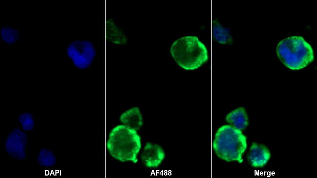 Galectin 10 Antibody in Immunocytochemistry (ICC/IF)