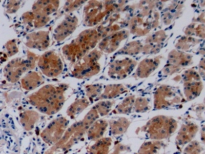 COL4A3 Antibody in Immunohistochemistry (Paraffin) (IHC (P))