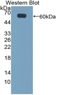 CILP Antibody in Western Blot (WB)