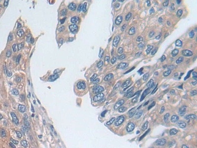 UTRN Antibody in Immunohistochemistry (Paraffin) (IHC (P))