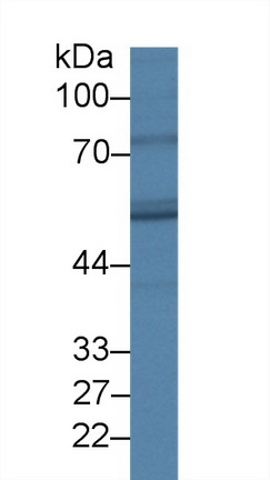 FADS3 Antibody in Western Blot (WB)