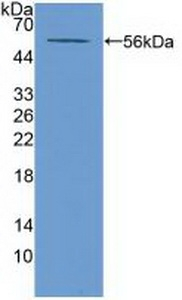 ABCA13 Antibody in Western Blot (WB)