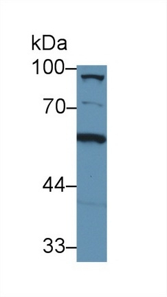 C8A Antibody in Western Blot (WB)