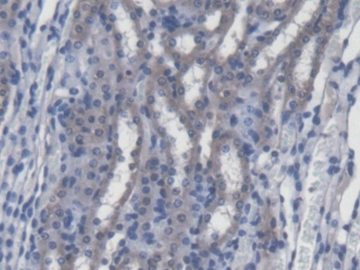 SREBP1 Antibody in Immunohistochemistry (Paraffin) (IHC (P))