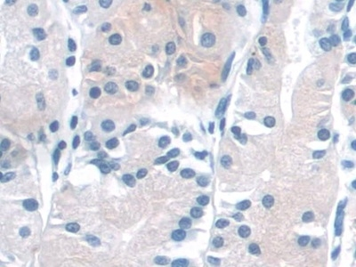 NADK Antibody in Immunohistochemistry (Paraffin) (IHC (P))