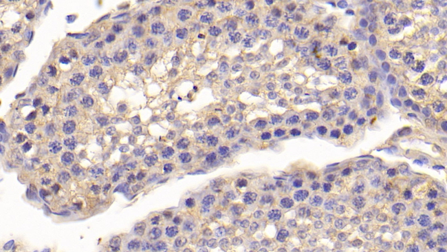 Osteocalcin Antibody in Immunohistochemistry (Paraffin) (IHC (P))