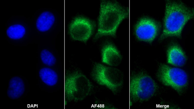 CD61 Antibody in Immunocytochemistry (ICC/IF)