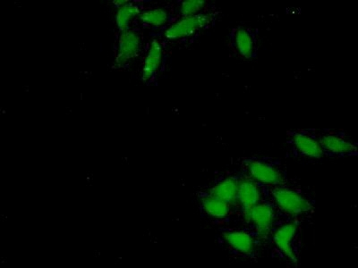 KEAP1 Antibody in Immunocytochemistry (ICC/IF)
