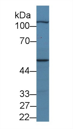 MYPN Antibody in Western Blot (WB)