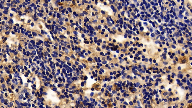 Tartrate Resistant Acid Phosphatase Antibody in Immunohistochemistry (Paraffin) (IHC (P))