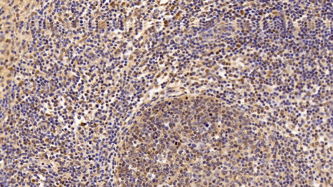 PTMA Antibody in Immunohistochemistry (Paraffin) (IHC (P))