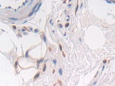 PTPRB Antibody in Immunohistochemistry (Paraffin) (IHC (P))