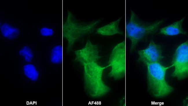 GPX6 Antibody in Immunocytochemistry (ICC/IF)