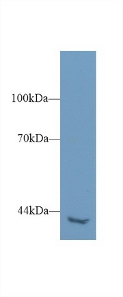 PLCH2 Antibody in Western Blot (WB)