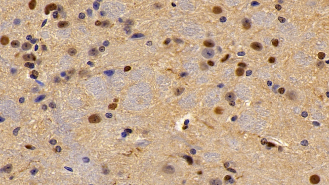 LXR beta Antibody in Immunohistochemistry (Paraffin) (IHC (P))