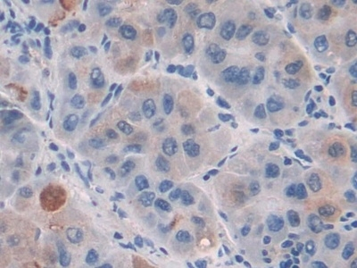 CILP Antibody in Immunohistochemistry (Paraffin) (IHC (P))