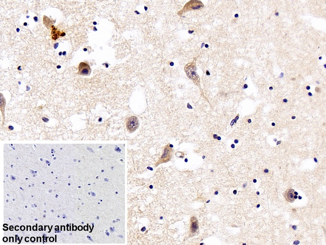 Furin Antibody in Immunohistochemistry (Paraffin) (IHC (P))