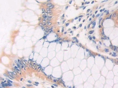 CECR1 Antibody in Immunohistochemistry (Paraffin) (IHC (P))
