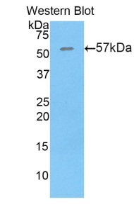 Thrombospondin 4 Antibody in Western Blot (WB)