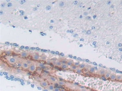 SERPINA3 Antibody in Immunohistochemistry (Paraffin) (IHC (P))
