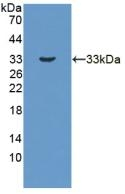 HSD17B3 Antibody in Western Blot (WB)