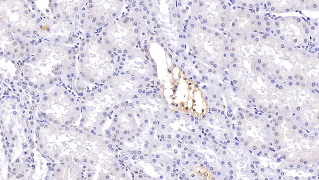 CFTR Antibody in Immunohistochemistry (Paraffin) (IHC (P))